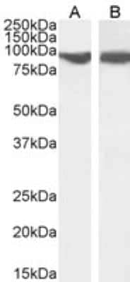 Western Blot: VPS35 Antibody [NB100-1397] - Staining of HepG2 (A) and HEK293 (B) cell lysate (35 ug protein in RIPA buffer). Antibody at 0.03 ug/mL. Detected by chemiluminescence.