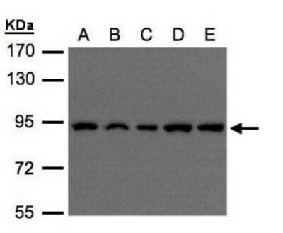 Western Blot: VPS35 Antibody [NBP1-31069] - Sample(30 ug of whole cell lysate)A:H1299B:HeLa S3 C:Hep G2 D:MOLT4 E:Raji 7. 5% SDS PAGE, antibody diluted at 1:500.