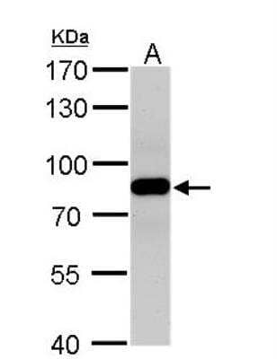 Western Blot: VPS35 Antibody [NBP1-31069] - A. 50 ug rat brain lysate/extract 7.5% SDS-PAGE VPS35 antibody dilution: 1:500 The HRP-conjugated anti-rabbit IgG antibody (NBP2-19301) was used to detect the primary antibody.