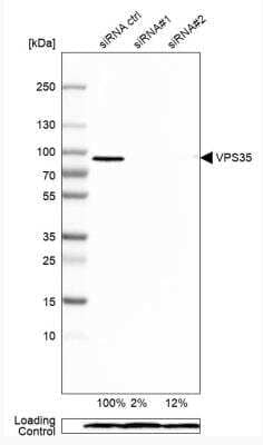 Western Blot: VPS35 Antibody [NBP2-13517] - Analysis in HEK293 cells transfected with control siRNA, target specific siRNA probe #1 and #2, using Anti-VPS35 antibody. Remaining relative intensity is presented. Loading control: Anti-PPIB.