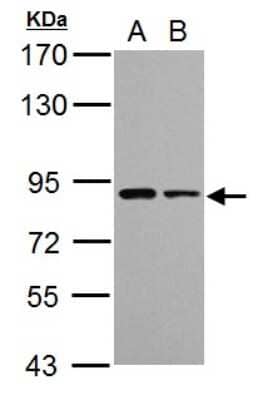 Western Blot: VPS35 Antibody [NBP2-20876] - Sample (30 ug of whole cell lysate) A: NIH-3T3 B: JC 7. 5% SDS PAGE gel, diluted at 1:1000.