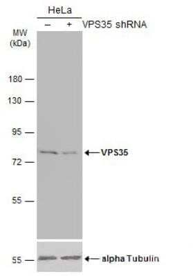 Western Blot: VPS35 Antibody [NBP2-20876] - Non-transfected (-) and transfected (+) HeLa whole cell extracts (30 ug) were separated by 7.5% SDS-PAGE, and the membrane was blotted with VPS35 antibody diluted at 1:1000. HRP-conjugated anti-rabbit IgG antibody was used to detect the primary antibody.