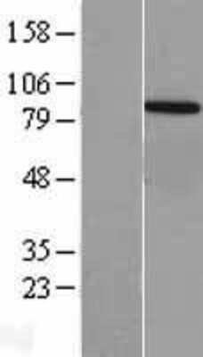 Western Blot: VPS35 Overexpression Lysate (Adult Normal) [NBL1-17746] Left-Empty vector transfected control cell lysate (HEK293 cell lysate); Right -Over-expression Lysate for VPS35.