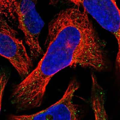 Immunocytochemistry/Immunofluorescence: VPS36 Antibody [NBP2-13518] - Staining of human cell line U-2 OS shows localization to vesicles & lysosomes.