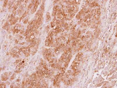 Immunohistochemistry-Paraffin: VPS36 Antibody [NBP2-20877] - Immunohistochemical analysis of paraffin-embedded DLD1 xenograft, using antibody at 1:100 dilution.