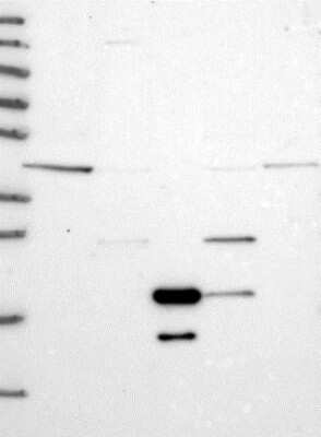 Western Blot: VPS36 Antibody [NBP2-13519] - Lane 1: Marker  [kDa] 250, 130, 95, 72, 55, 36, 28, 17, 10.  Lane 2: Human cell line RT-4.  Lane 3: Human cell line U-251MG.  Lane 4: Human Plasma.  Lane 5: Human liver tissue.  Lane 6: Human tonsil tissue