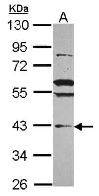 Western Blot VPS36 Antibody