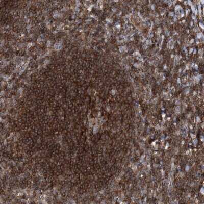 Immunohistochemistry: VPS37B Antibody [NBP2-38398] - Staining of human tonsil shows strong cytoplasmic positivity in non-germinal center cells.