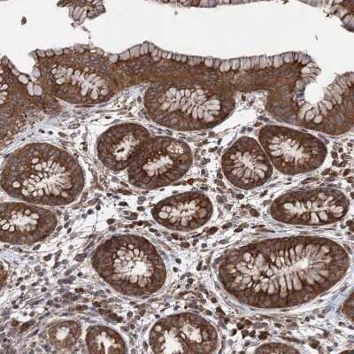 Immunohistochemistry-Paraffin: VPS37B Antibody [NBP1-82283] - Staining of human stomach shows strong cytoplasmic positivity in glandular cells.