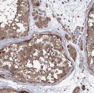 Immunohistochemistry-Paraffin: VPS37B Antibody [NBP1-82283] - Staining of human testis shows moderate cytoplasmic positivity in cells in seminiferous ducts.