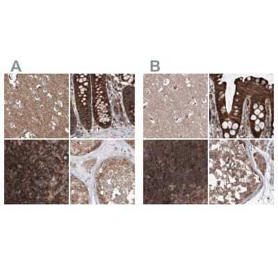 <b>Independent Antibodies Validation. </b>Immunohistochemistry-Paraffin: VPS37B Antibody [NBP2-38398] - Staining of human cerebral cortex, colon, lymph node and testis using Anti-VPS37B antibody NBP2-38398 (A) shows similar protein distribution across tissues to independent antibody NBP1-82283 (B).