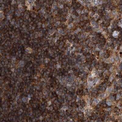 Immunohistochemistry-Paraffin: VPS37B Antibody [NBP2-38398] - Staining of human lymph node.