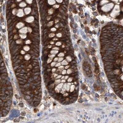 <b>Independent Antibodies Validation. </b>Immunohistochemistry-Paraffin: VPS37B Antibody [NBP2-38398] - Staining of human colon.