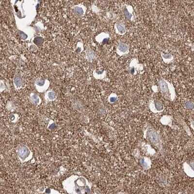 Immunohistochemistry-Paraffin: VPS37B Antibody [NBP2-38398] - Staining of human cerebral cortex.