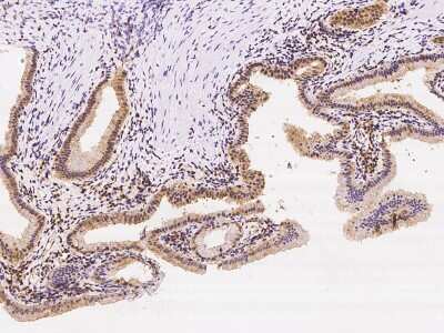 Immunohistochemistry-Paraffin: VPS37B Antibody [NBP3-06284] - Immunochemical staining of human VPS37B in human gallbladder with rabbit polyclonal antibody at 1:100 dilution, formalin-fixed paraffin embedded sections.