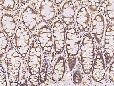 Immunohistochemistry-Paraffin: VPS37B Antibody [NBP3-06284] - Immunochemical staining of human VPS37B in human rectum with rabbit polyclonal antibody at 1:100 dilution, formalin-fixed paraffin embedded sections.