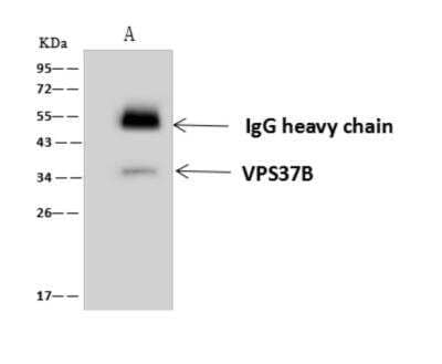 Immunoprecipitation: VPS37B Antibody [NBP3-06284] - VPS37B was immunoprecipitated using:Lane A:0.5 mg U251 MG Whole Cell Lysate4 uL anti-VPS37B rabbit polyclonal antibody and 60 ug of Immunomagnetic beads Protein AG.Primary antibody:Anti-VPS37B rabbit polyclonal antibody, at 1:100 dilution Secondary antibody:Goat Anti-Rabbit IgG (H+L)HRP   at 110000 dilutionDeveloped using the ECL technique.Performed under reducing conditions.Predicted band size: 35 kDaObserved band size :35 kDa