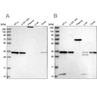 Western Blot VPS37B Antibody