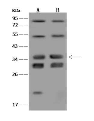 Western Blot VPS37B Antibody