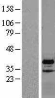 Western Blot VPS37B Overexpression Lysate