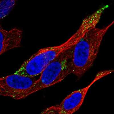 Immunocytochemistry/ Immunofluorescence VPS37D Antibody