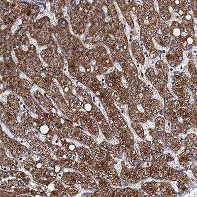 Immunohistochemistry VPS37D Antibody