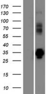 Western Blot: VPS37D Overexpression Lysate (Adult Normal) [NBP2-08464] Left-Empty vector transfected control cell lysate (HEK293 cell lysate); Right -Over-expression Lysate for VPS37D.