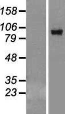 Western Blot: VPS39 Overexpression Lysate (Adult Normal) [NBL1-17750] Left-Empty vector transfected control cell lysate (HEK293 cell lysate); Right -Over-expression Lysate for VPS39.