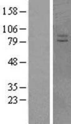 Western Blot: VPS41 Overexpression Lysate (Adult Normal) [NBL1-17751] Left-Empty vector transfected control cell lysate (HEK293 cell lysate); Right -Over-expression Lysate for VPS41.