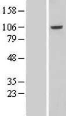 Western Blot: VPS41 Overexpression Lysate (Adult Normal) [NBL1-17752] Left-Empty vector transfected control cell lysate (HEK293 cell lysate); Right -Over-expression Lysate for VPS41.