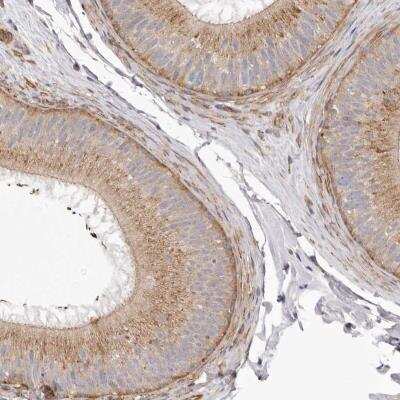 Immunohistochemistry: VPS45 Antibody [NBP1-81641] - Staining of human epididymis shows cytoplasmic positivity in glandular cells.