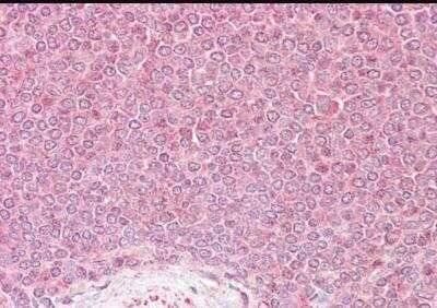 Immunohistochemistry-Paraffin: VPS45 Antibody [NB100-2431] - Staining of Human Spleen. Steamed antigen retrieval with citrate buffer pH 6, AP-staining.taining of paraffin embedded Human Spleen. Steamed antigen retrieval with citrate buffer pH 6, AP-staining.