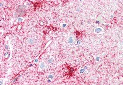 Immunohistochemistry-Paraffin: VPS45 Antibody [NB100-41372] - Staining of paraffin embedded Human Cortex. Antibody at 5 ug/mL. Steamed antigen retrieval with citrate buffer pH 6, AP-staining.