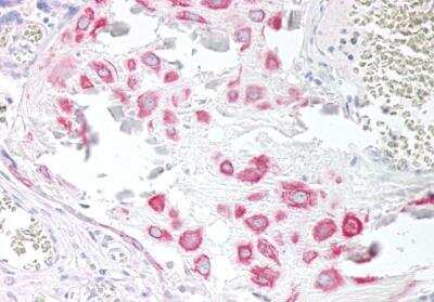 Immunohistochemistry-Paraffin: VPS45 Antibody [NB100-41372] - Staining of paraffin embedded Human Placenta.Antibody at 5 ug/mL. Steamed antigen retrieval with citrate buffer pH 6, AP-staining.