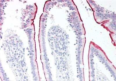 Immunohistochemistry-Paraffin: VPS45 Antibody [NB100-41372] - Staining of paraffin embedded Human Small Intestine. Antibody at 5 ug/mL. Steamed antigen retrieval with citrate buffer pH 6, AP-staining.