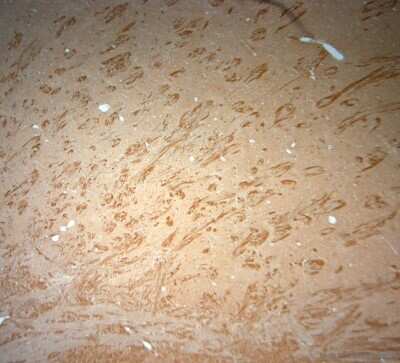 Immunohistochemistry-Paraffin: VPS45 Antibody [NB100-98931] - IHC-P on paraffin sections of rat brain.The animal was perfused using Autoperfuser at a pressure of 130 mmHg with 300 ml 4% FA before being processed for paraffin embedding. HIER: Tris-EDTA, pH 9 for 20 min.Blocking: 0.2% LFDM in TBST filtered thru 0.2 um.Detection was done using  HRP polymer from  manufacturers instructions; DAB chromogen.Primary antibody: dilution 1: 1000, incubated 30 min at RT using Autostainer.Sections were counterstained with Harris Hematoxylin.