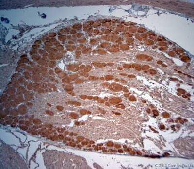 Immunohistochemistry-Paraffin: VPS45 Antibody [NB100-98931] - IHC-P on paraffin sections of rat DRG.The animal was perfused using Autoperfuser at a pressure of 130 mmHg with 300 ml 4% FA before being processed for paraffin embedding. HIER: Tris-EDTA, pH 9 for 20 min.Blocking: 0.2% LFDM in TBST filtered thru 0.2 um.Detection was done using  HRP polymer from  manufacturers instructions; DAB chromogen.Primary antibody: dilution 1: 1000, incubated 30 min at RT using Autostainer.Sections were counterstained with Harris Hematoxylin.