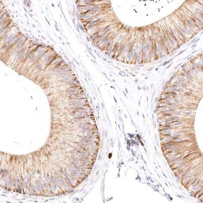 Immunohistochemistry-Paraffin: VPS45 Antibody [NBP1-81642] - Staining of human epididymis shows cytoplasmic positivity in glandular cells.