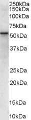 Western Blot: VPS45 Antibody [NB100-2431] - (0.03ug/ml) staining of human placenta lysate (35ug protein in RIPA buffer). Primary incubation was 1 hour. Detected by chemiluminescence.