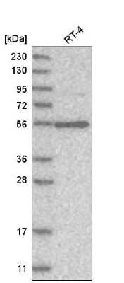 Western Blot: VPS45 Antibody [NBP1-81642] - Analysis in human cell line RT-4.