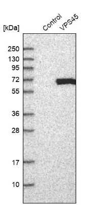 Western Blot: VPS45 Antibody [NBP1-81642] - Analysis in control (vector only transfected HEK293T lysate) and VPS45 over-expression lysate (Co-expressed with a C-terminal myc-DDK tag (3.1 kDa) in mammalian HEK293T cells).