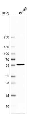 Western Blot: VPS45 Antibody [NBP1-81642] - Analysis in human cell line RH-30.