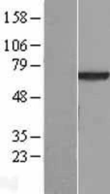 Western Blot: VPS45 Overexpression Lysate (Adult Normal) [NBL1-17753] Left-Empty vector transfected control cell lysate (HEK293 cell lysate); Right -Over-expression Lysate for VPS45.