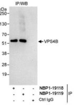 Immunoprecipitation: VPS4B Antibody [NBP1-19118] - Whole cell lysate (1 mg for IP, 20% of IP loaded) from HeLa cells. Affinity purified rabbit anti-VPS4B antibody used for IP at 3 mcg/mg lysate. VPS4B was also immunoprecipitated by rabbit anti- VPS4B antibody NBP1-19119, which recognizes a downstream epitope