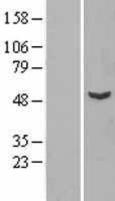 Western Blot: VPS4B Overexpression Lysate (Adult Normal) [NBL1-17755] Left-Empty vector transfected control cell lysate (HEK293 cell lysate); Right -Over-expression Lysate for VPS4B.