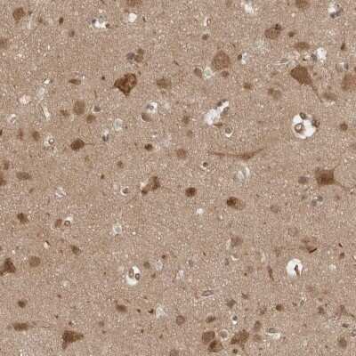 Immunohistochemistry-Paraffin: VPS50 Antibody [NBP1-88012] - Immunohistochemical staining of human cerebral cortex shows positivity in neuronal and glial cells.