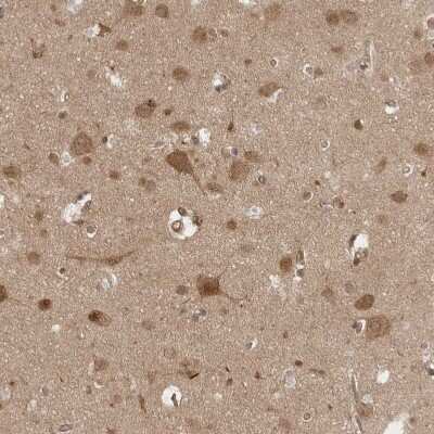 Immunohistochemistry-Paraffin: VPS50 Antibody [NBP1-88012] - Staining of human cerebral cortex shows moderate cytoplasmic positivity in neurons.