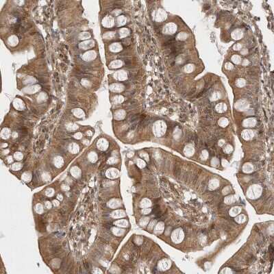 Immunohistochemistry-Paraffin: VPS50 Antibody [NBP1-88012] - Staining of human small intestine shows moderate cytoplasmic positivity in glandular cells.