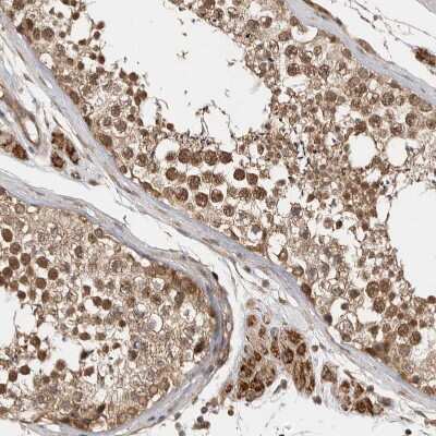 Immunohistochemistry-Paraffin: VPS50 Antibody [NBP1-88012] - Staining of human testis shows moderate to strong cytoplasmic and nuclear positivity in cells in seminiferous ducts.