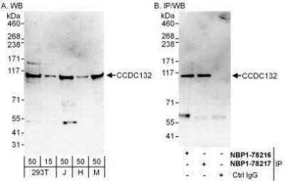 Western Blot: VPS50 Antibody [NBP1-78216] - Whole cell lysate from 293T (15 and 50 mcg for WB; 1 mg for IP, 20% of IP loaded), Jurkat (J; 50 mcg), HeLa (H; 50 mcg) and NIH3T3 (M; 50 mcg) cells. Antibodies: Affinity purified rabbit anti-CCDC132 antibody used for WB at 0.04 mcg/ml (A) and 0.4 mcg/ml (B) and used for IP at 6 mcg/mg lysate.  CCDC132 was also immunoprecipitated by rabbit anti-CCDC132 antibody NBP1-78217, which recognizes a downstream epitope.